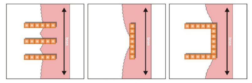 Figure 2. Examples of orientation of dwellings.